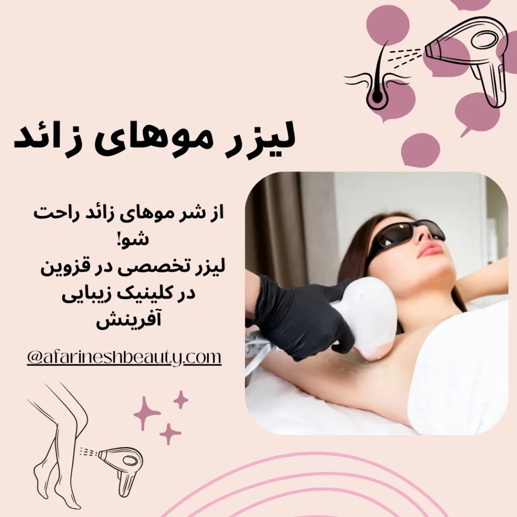 لیزر موهای زائد در قزوین